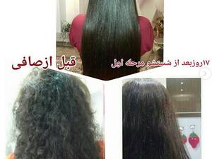 انجام مرحله دوم بعد از گذشت ۳هفته