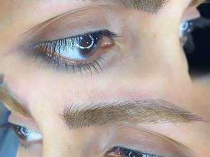 میکروبلیدینگ فیبروز ابرو نچرال