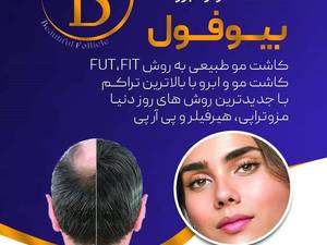 کاشت ابرو قیمت استثنایی تهران