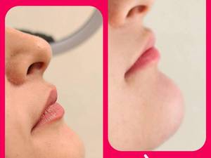 بهترین کلینیک زیبایی در رشت