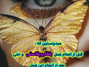 تزریق مزو ژل در رشت