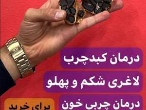 قیمت سیر سیاه دکتر بیز در اصفهان