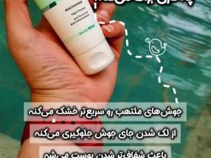 بهترین کرم ضد جوش گاتیو در تهران