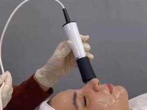 هزینه پلاژن تراپی در اهواز