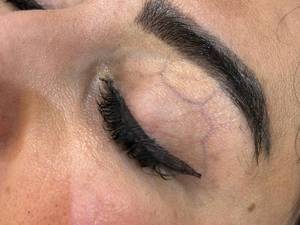 لیفت ابرو در آرایشگاه در بندانزلی