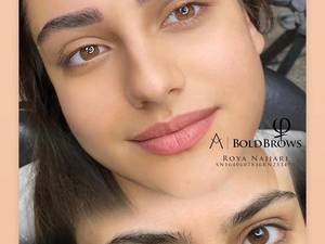 مرکز تخصصی بولدبروز ابرو در تبریز