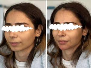 کانتور صورت حرفه‌ای در لاهیجان