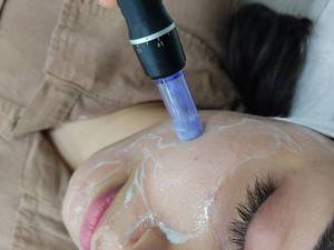 قیمت پاکسازی پوست زنانه و مردانه در اهواز