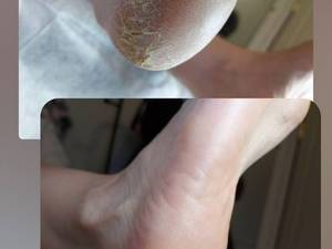 آموزش پدیکور و مانیکور حرفه‌ای در کرمانشاه  