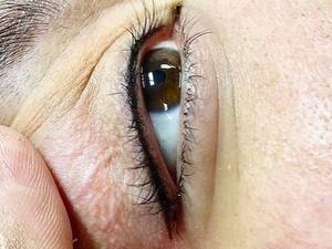 بهترین مرکز بنمژه دائم در کرمانشاه