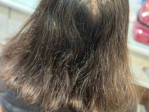 هزینه بالیاژ مش با فویل در انزلی