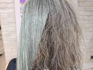 درمان موهای وز در تهران