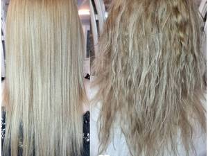 درمان موهای وز در تهران