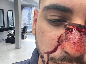 آموزش گریم زخم سینمایی در تهران