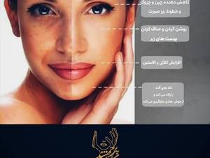 مرکز لیزر موای زائد در شادآباد