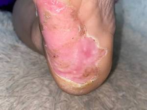 کلنیک زخم دیابتی نعمتی در آمل