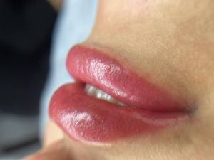 بهترین مرکز شیدینگ لب در ساری