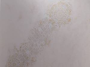 اجرای تخصصی میکروسمت نما در شمال تهران