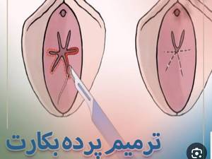 بهترین مطب هایمنو پلاستی در درود لرستان