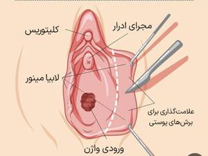 بهترین مطب لابیا پلاستی دردرود لرستان