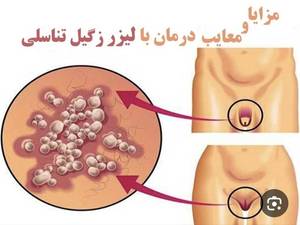 بهترین مطب درمان زگیل تناسلی زنان در درود 