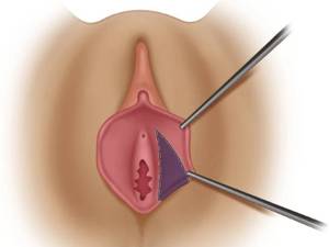 نوبت مشاوره هایمنو پلاستی درلرستان