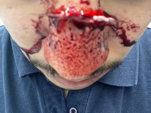 آموزش گریم زخم به صورت حرفه ای در شهر قدس