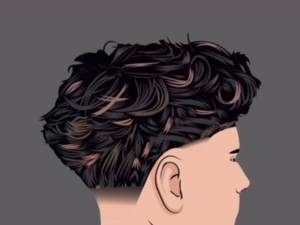 هزینه نصب پروتز مو جلو سر در تهرانسر