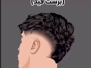 هزینه نصب پروتز مو جلو سر در تهرانسر