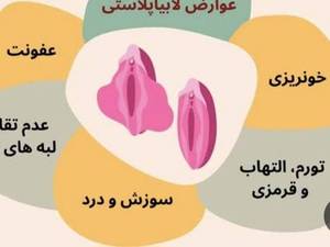 بهترین دکتر لابیا پلاستی با لیزرو جوانسازی واژن در اهواز