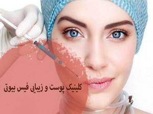 هزینه فیلر چانه در بوشهر