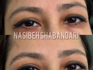 متخصص اصلاح ابرو در رشت