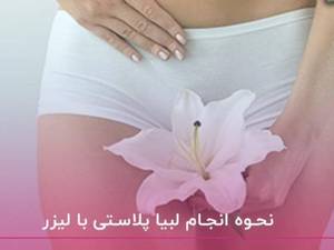 جراحی لابیاپلاستی در خرم آباد