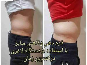 فرم دهی بدن