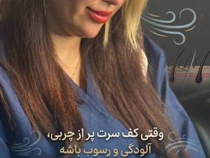اسکراپ اسکالپ