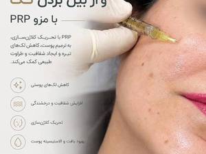 مزو PRP برای جوانسازی و بهبود کیفیت پوست