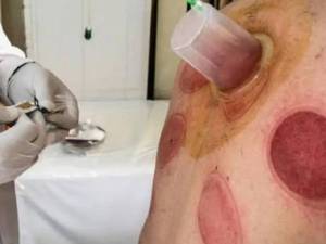 حجامت با رعایت اصول بهداشتی و نوبت‌دهی منظم