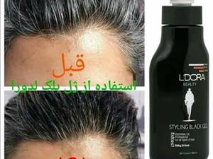 ژل موبلک لدورا