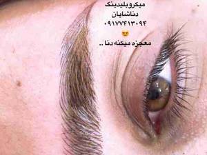 میکروبلیدینگ ابرو به صورت تخصصی