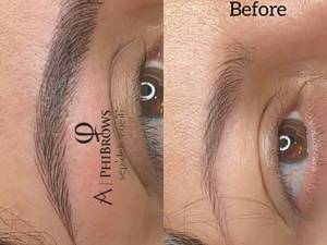 میکروبلیدینگ به روش بلدبروز روی ابرو