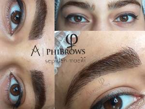 میکروبلیدینگ به روش بلدبروز