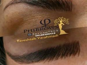 فیبروز در اراک