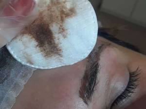 ریمو و پاک کردن تاتو ابرو در گیلان