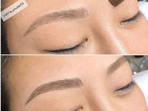 انجام فیبروز به صورت کاملا حرفه ای در شیراز