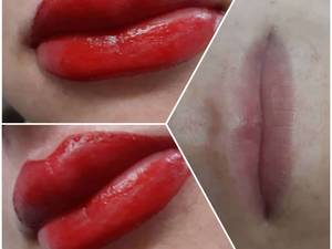 کانتور دائمی لب بدون درد و خونریزی  در آمل