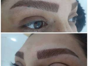 کار فیبروز بدون درد در سالن زیبایی سارا رمضانی