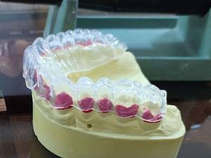 تری بلیچینگ حرفه ایی در اصفهان