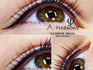 انجام فی کانتور چشم در مشهد