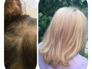 انجام ترکیب لایت بالیاژ و کلاسیک در مشهد