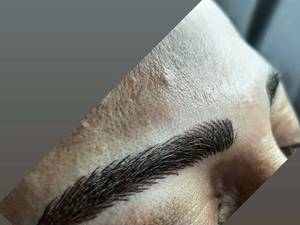 اجرای میکروبلیدینگ روی ابرو تاتو شده